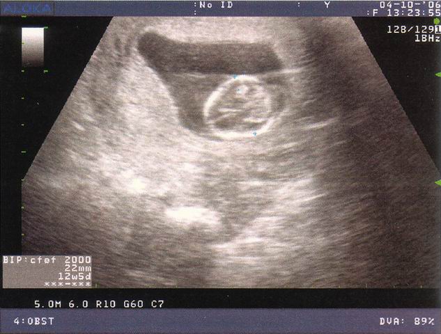 2006.10.04 echo2.jpg